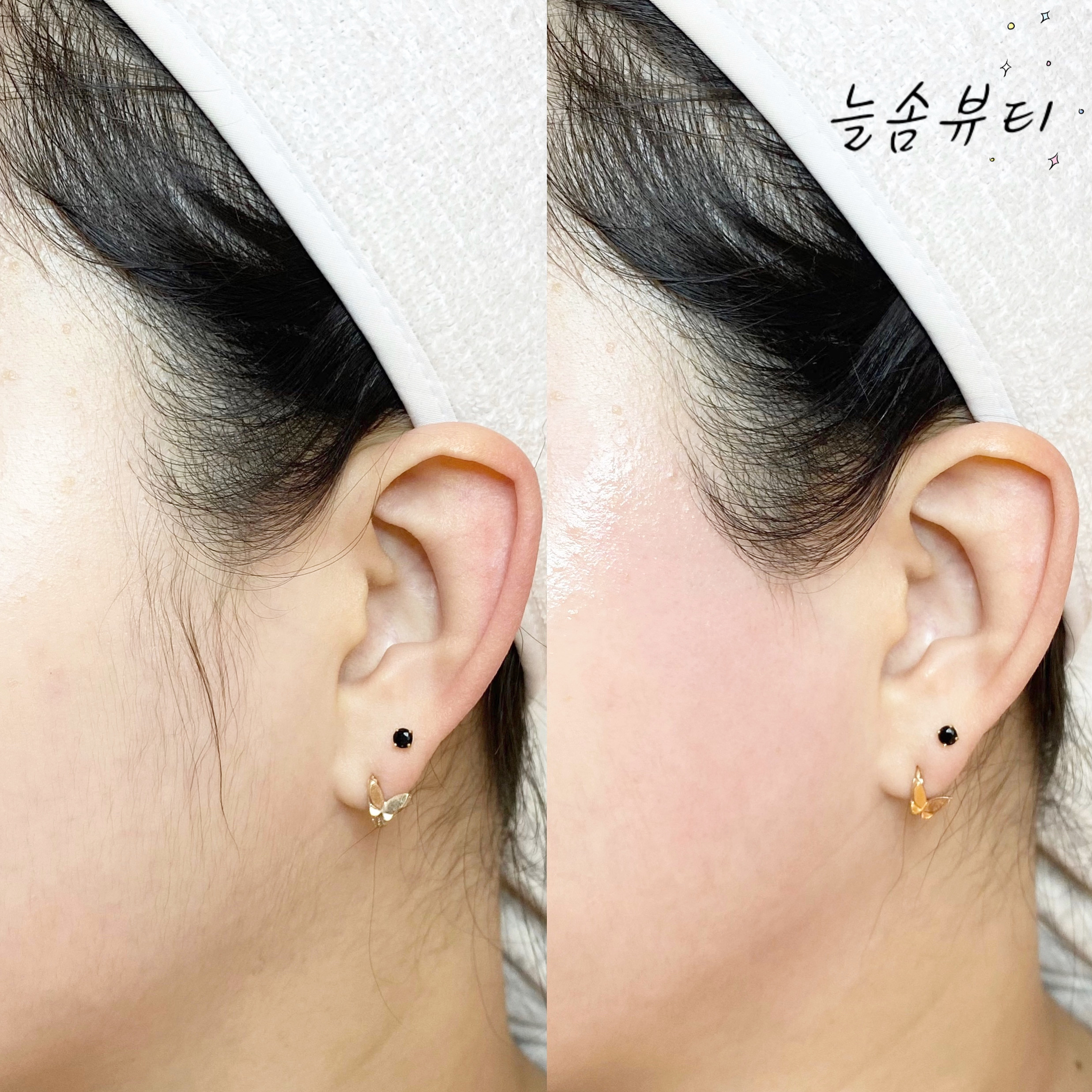 늘솜뷰티
