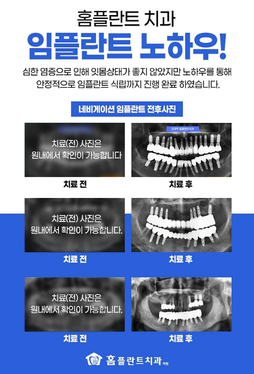 홈플란트치과의원