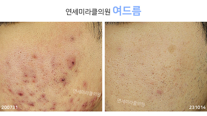 연세미라클의원 대표 이미지