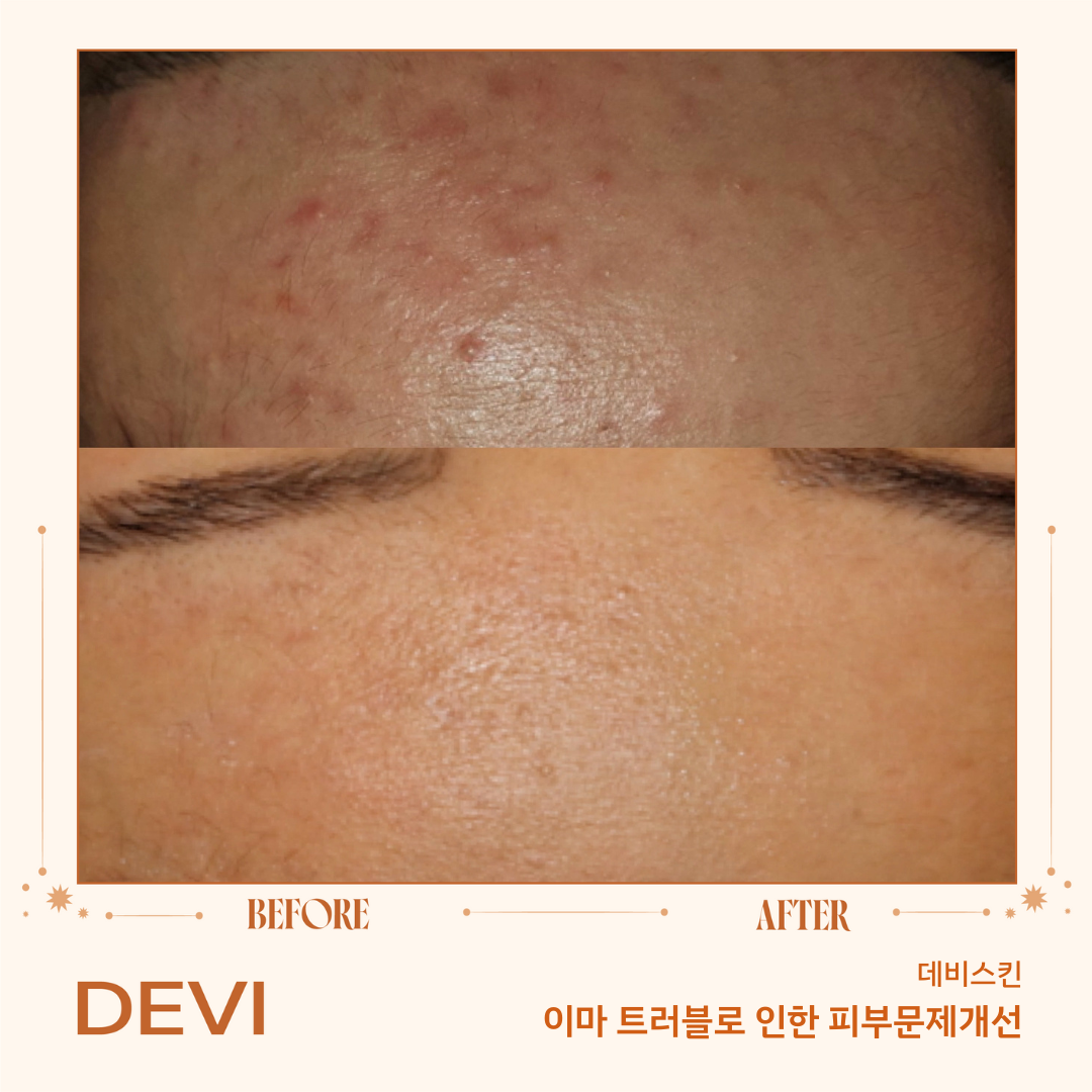 데비스킨 인천점 대표 이미지