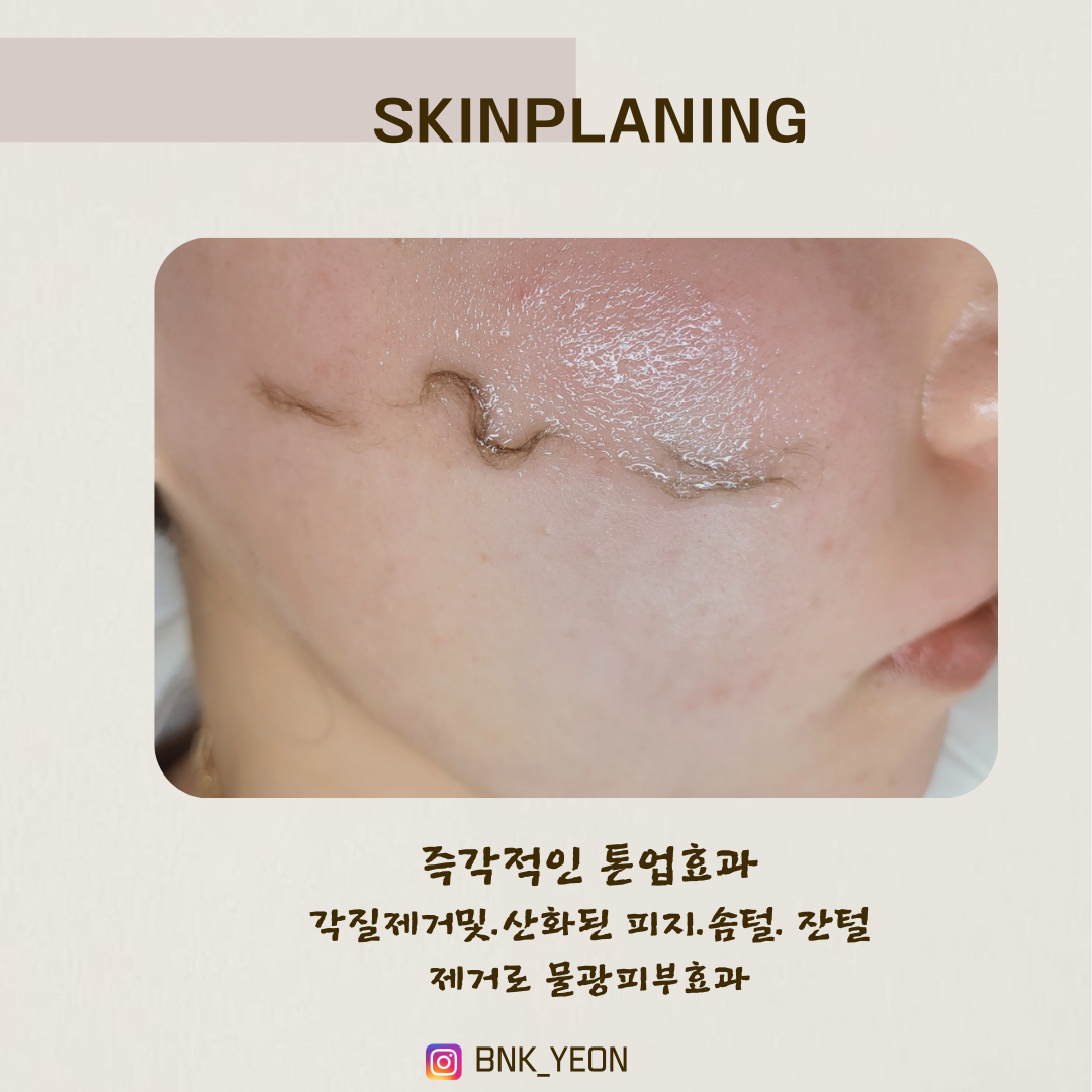 천안왁싱 뷰티앤케이