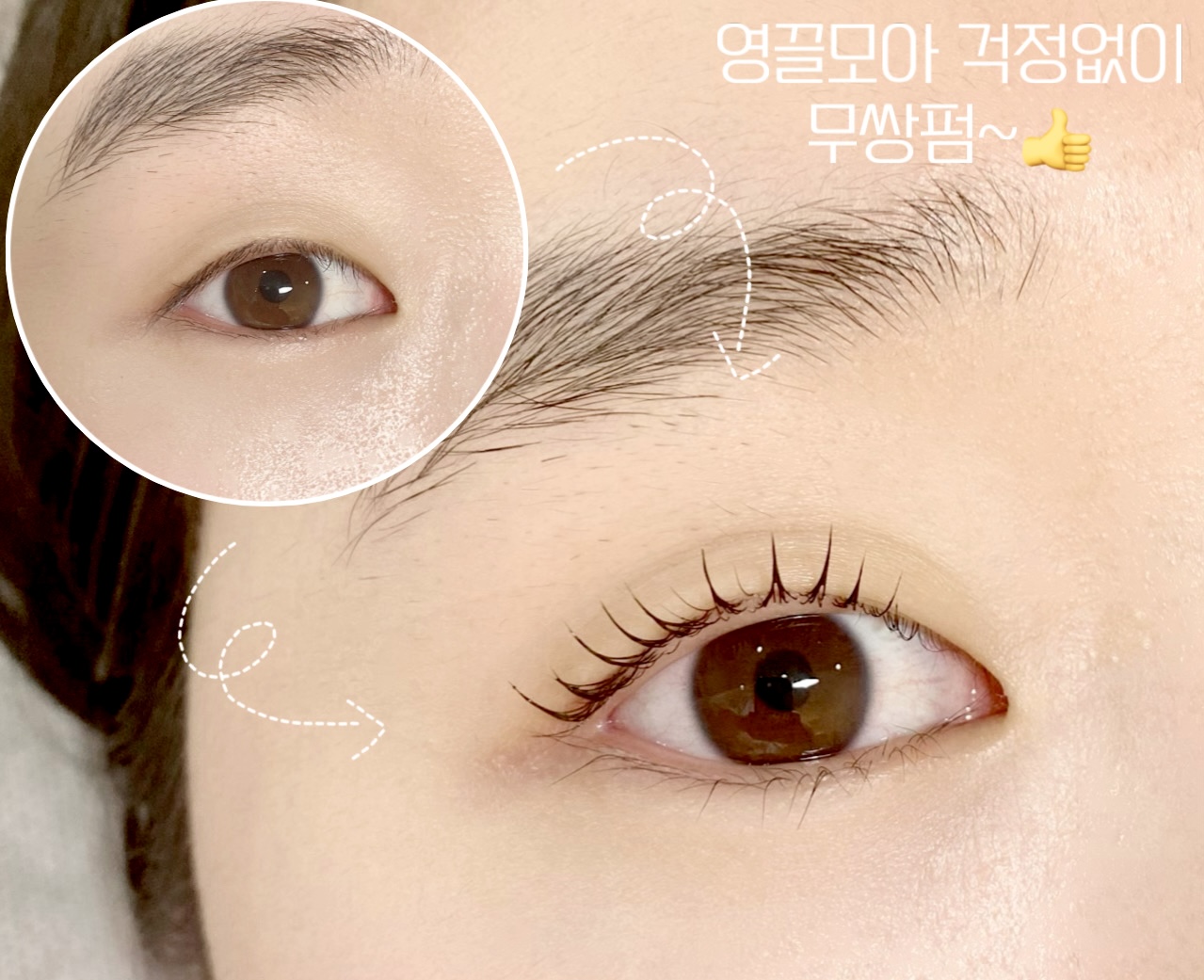 눈시울에난털
