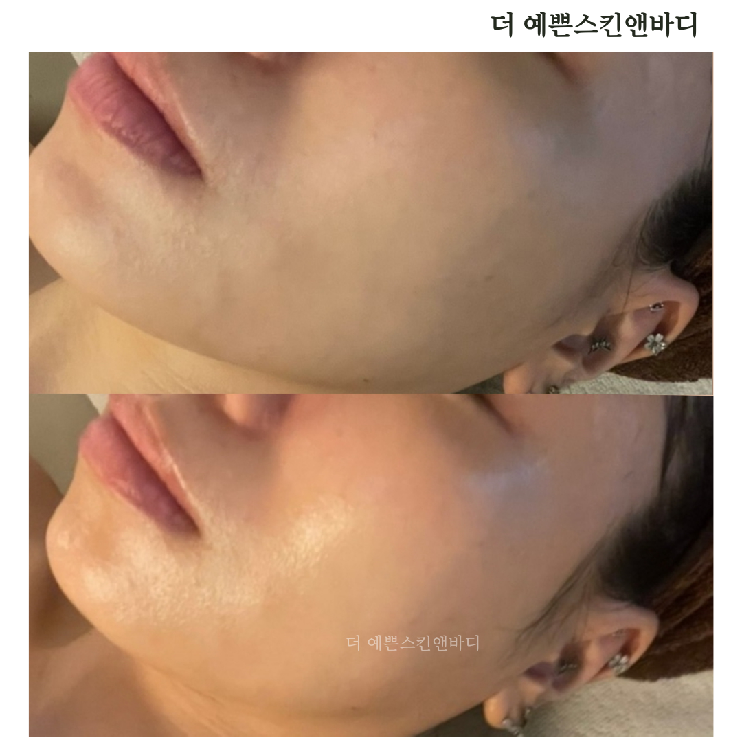 더예쁜스킨앤바디