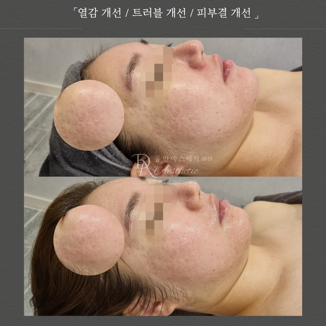 동안에스테틱 | 고객님의 피부상태에 맞춰 좋은 피부케어를 제공하는 동래의 곳