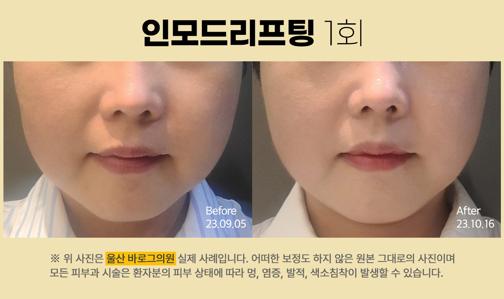 바로그의원 울산 대표 이미지