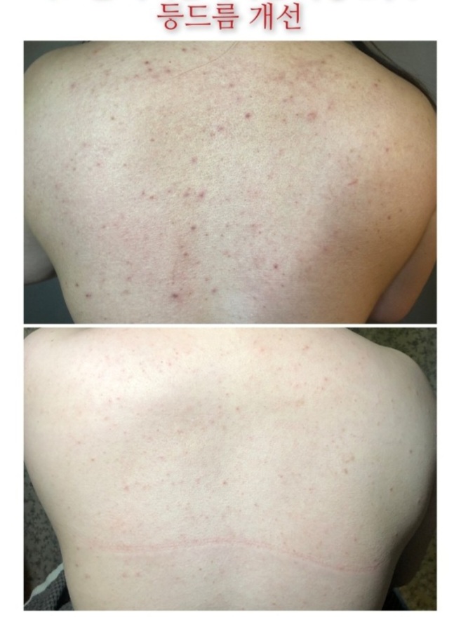 톡톡스킨 대표 이미지