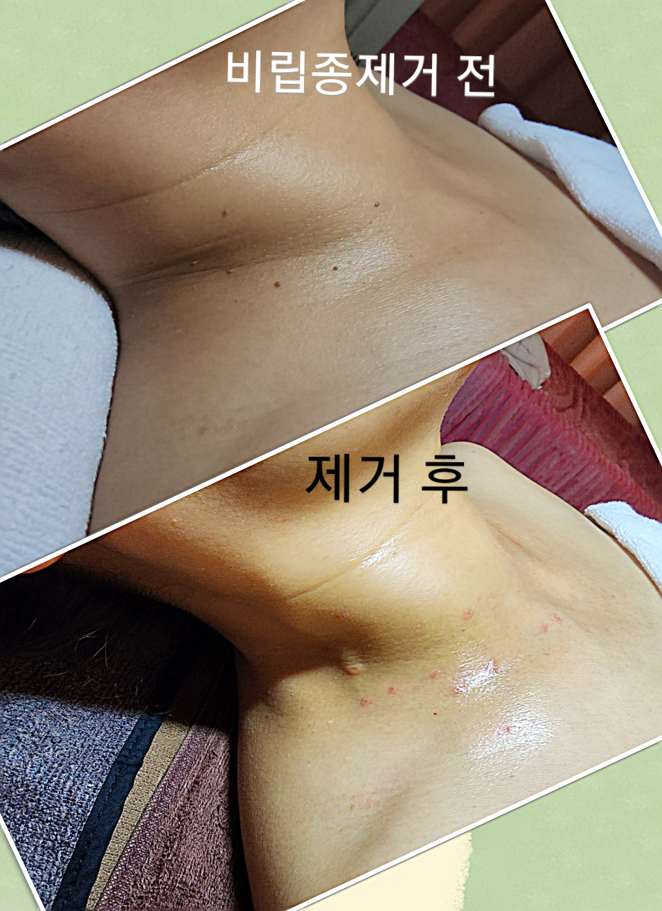 톡톡스킨 대표 이미지