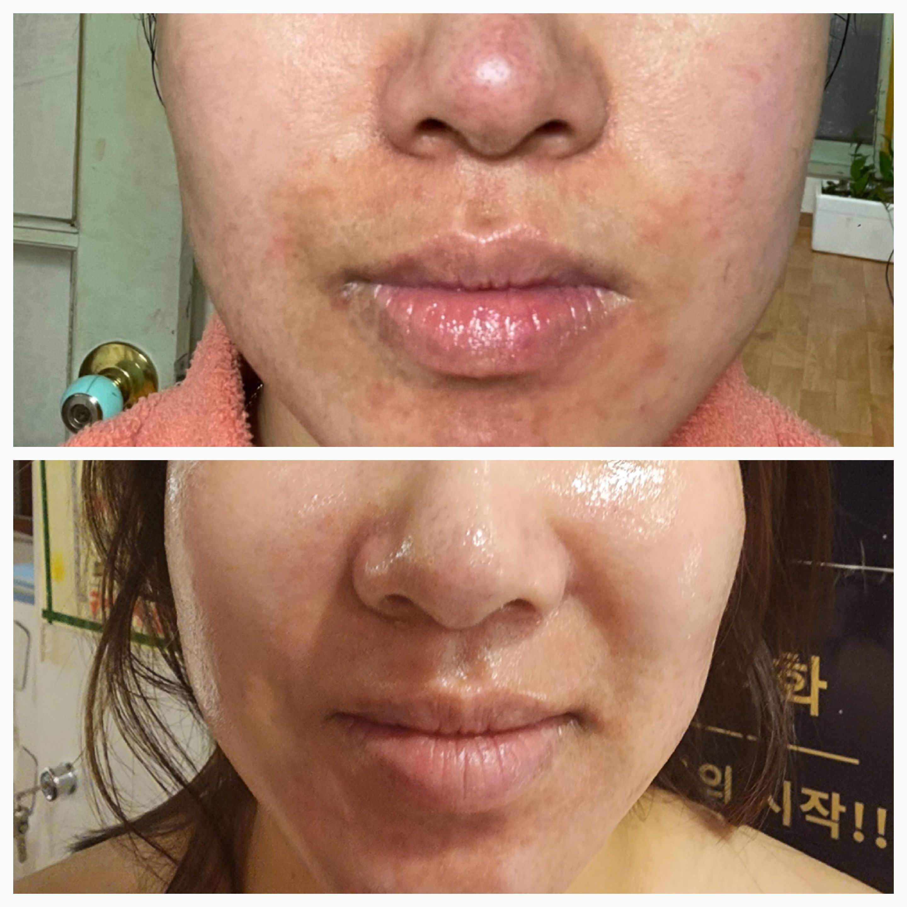 톡톡스킨 고양시본점 대표 이미지