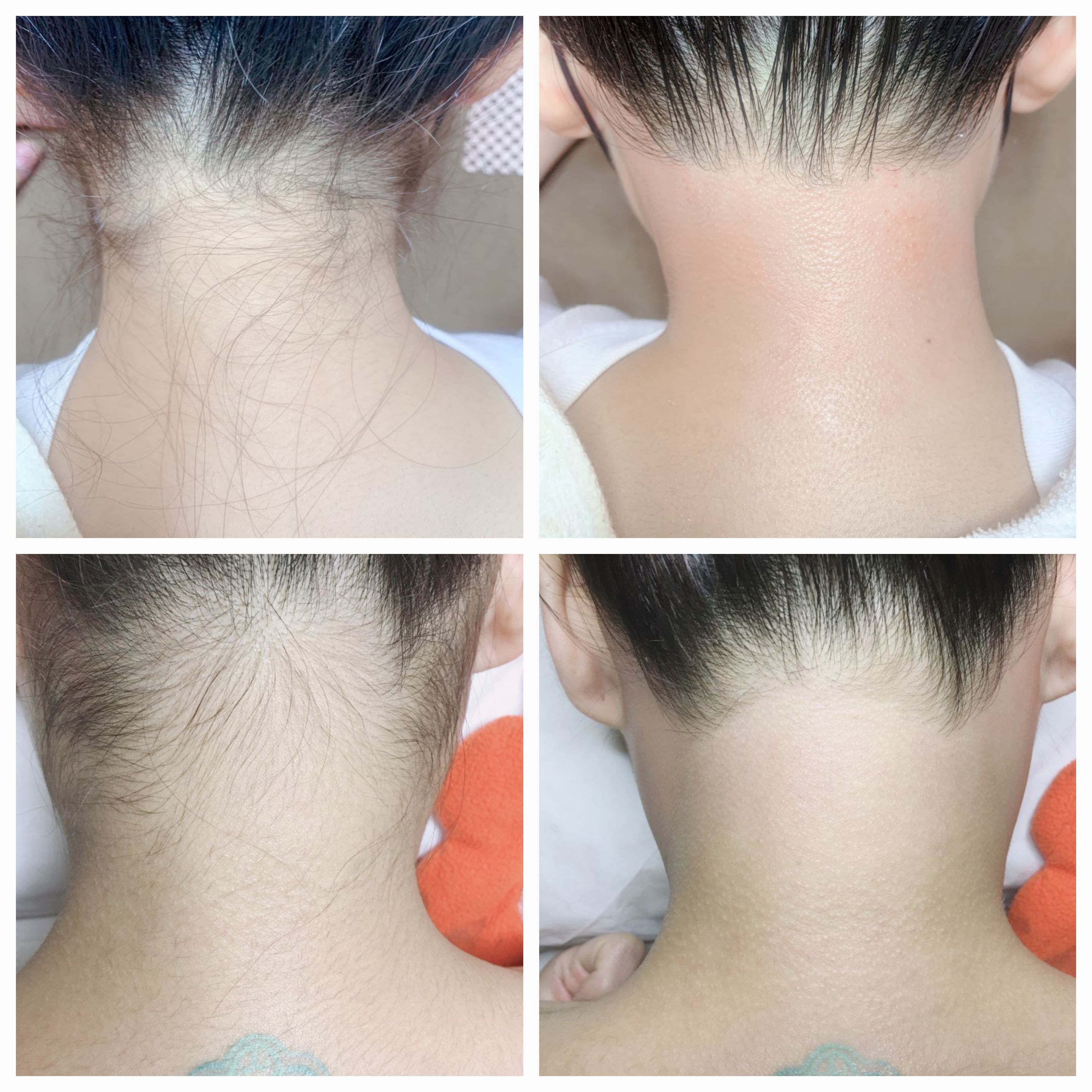 톡톡스킨 고양시본점 대표 이미지