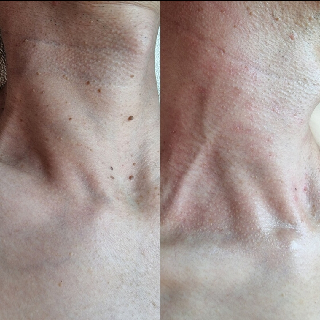 톡톡스킨 대표 이미지