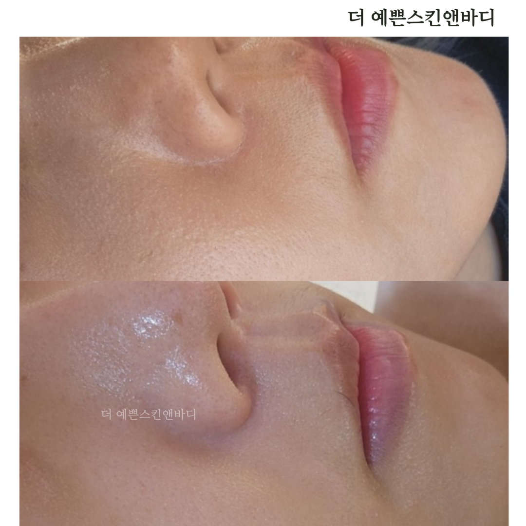 더예쁜스킨앤바디