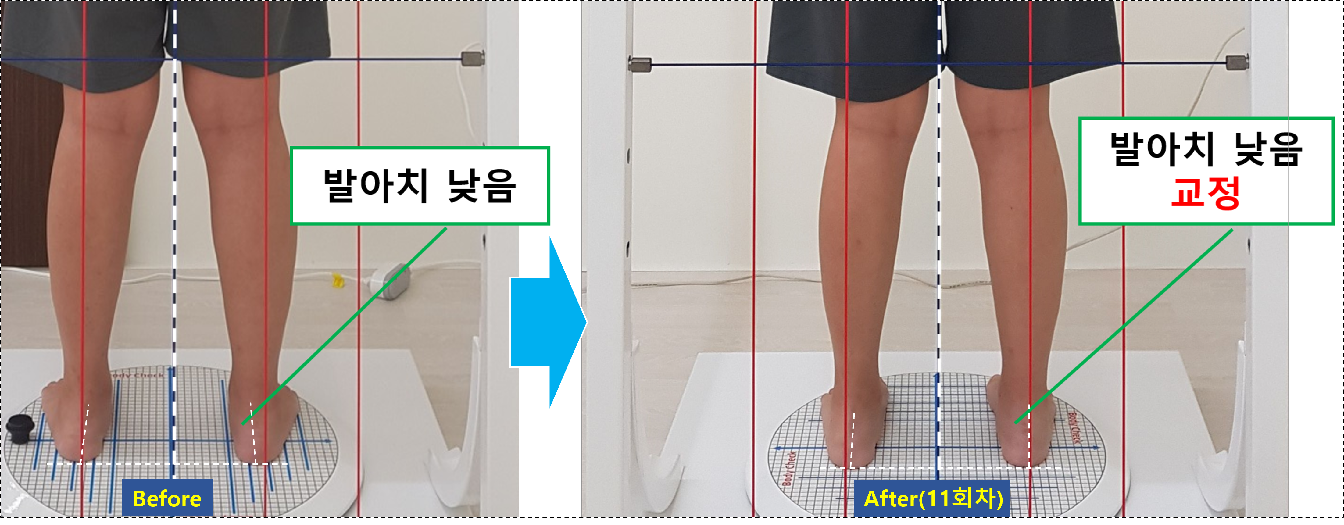 바로세움자세교정센터 창원용호동점