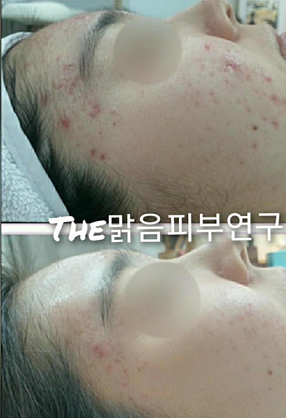 더맑음피부연구소 대표 이미지