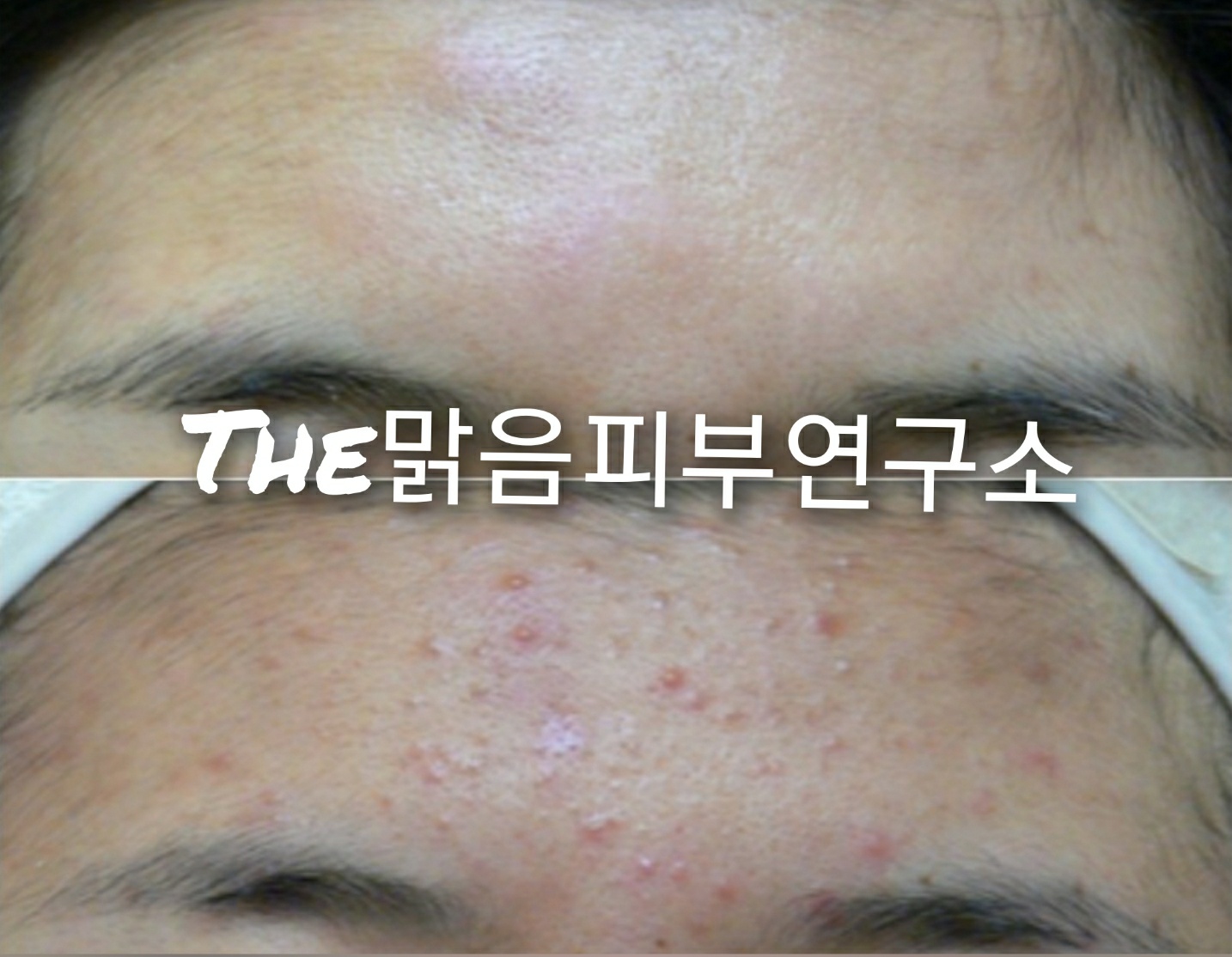 더맑음피부연구소 대표 이미지