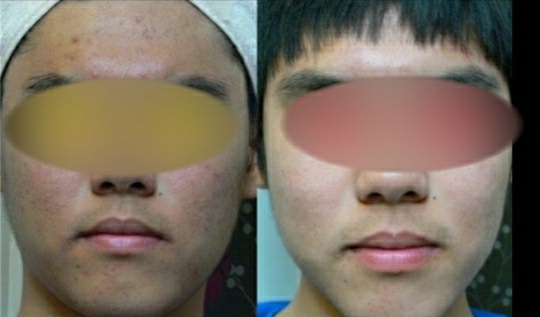 더맑음피부연구소 대표 이미지