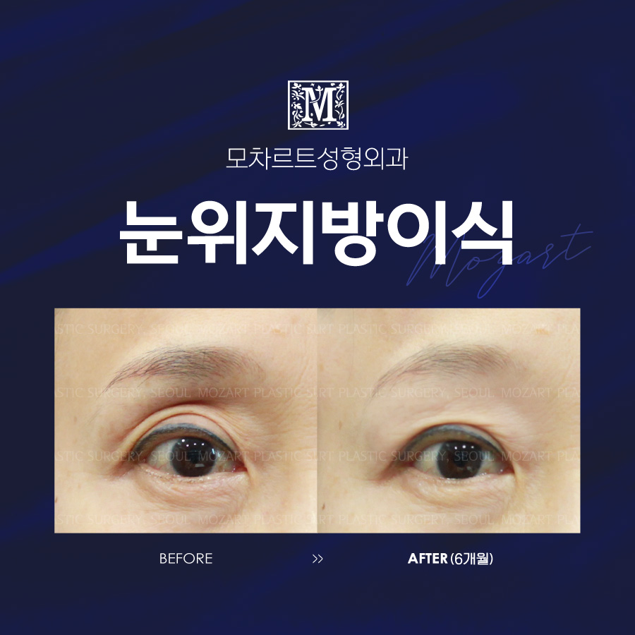 모차르트성형외과의원 대표 이미지