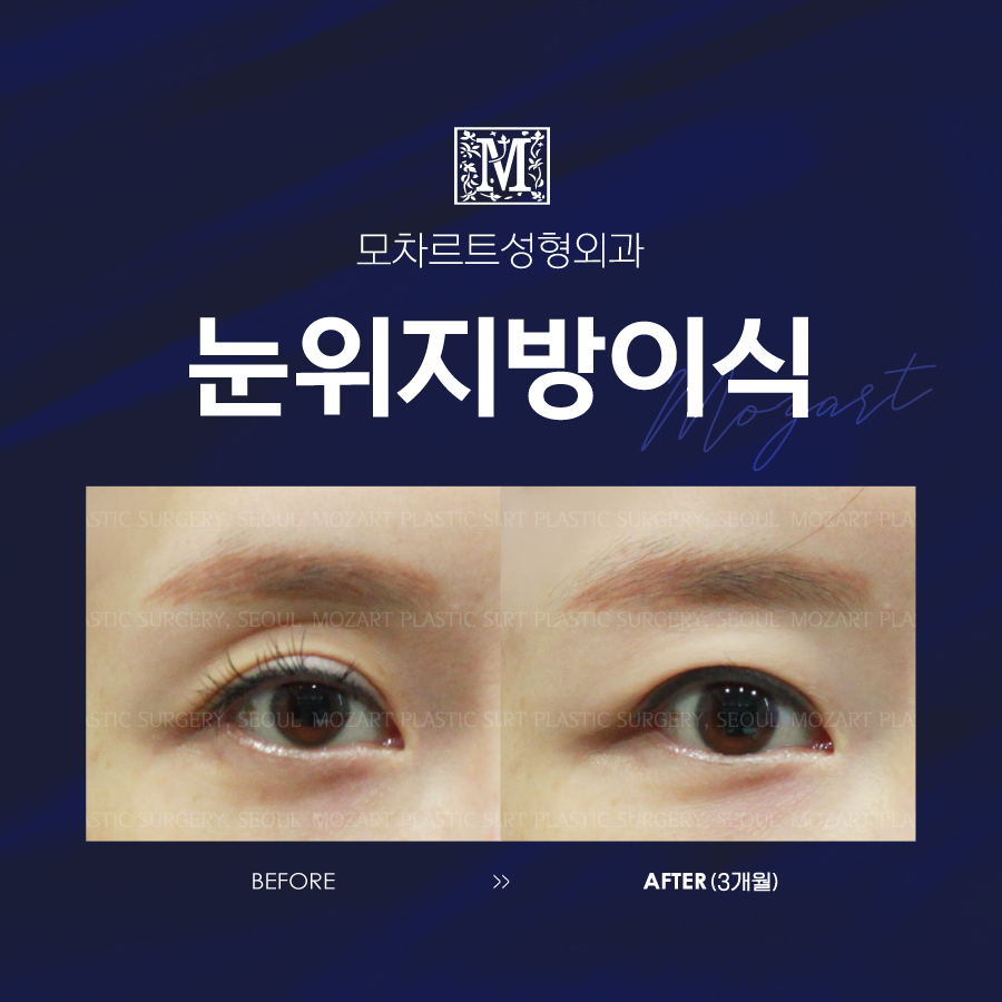 모차르트성형외과 대표 이미지