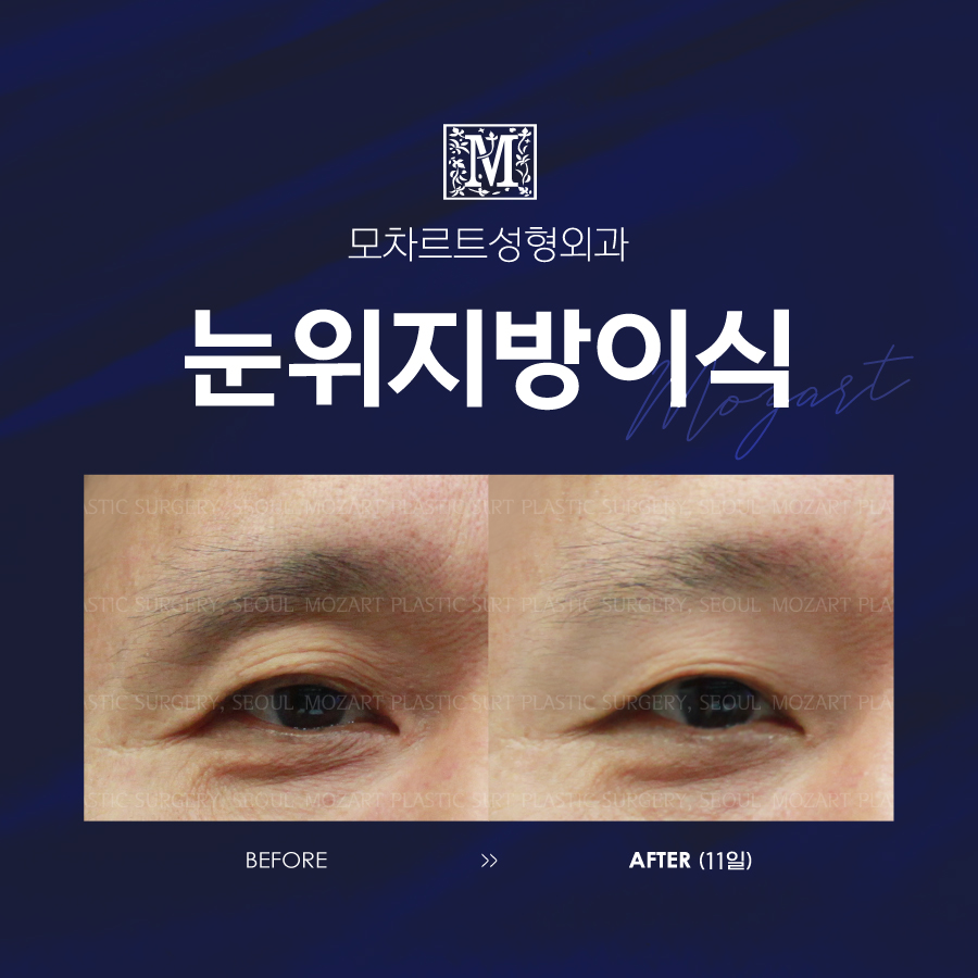 모차르트성형외과의원 대표 이미지