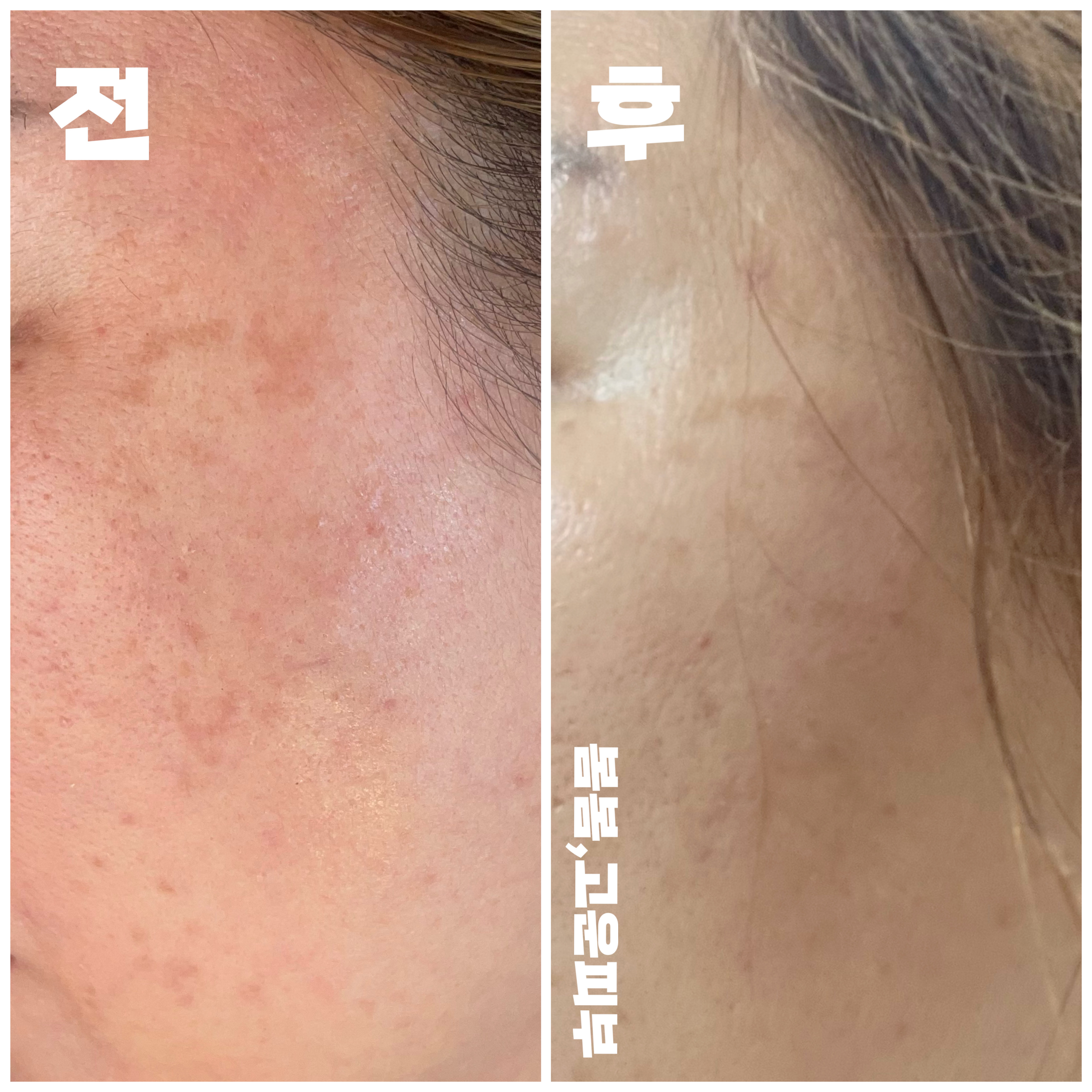 봄봄고운피부 이미지