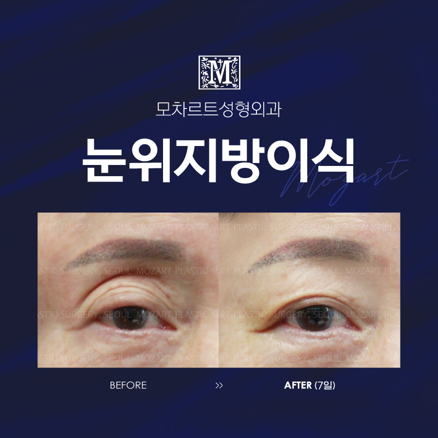 모차르트성형외과의원 대표 이미지