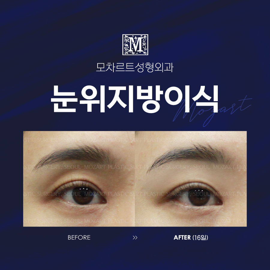 모차르트성형외과의원 대표 이미지