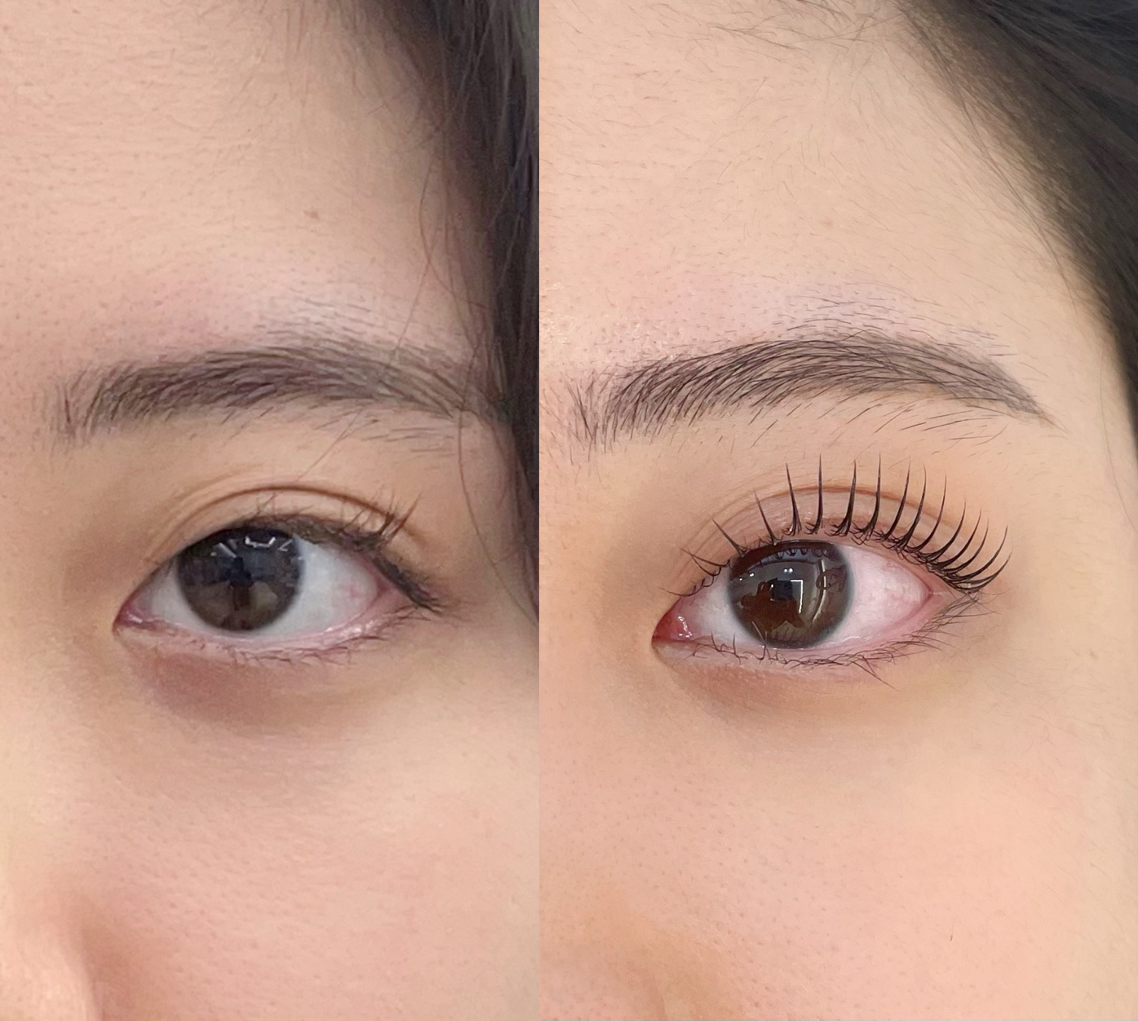 힐링뷰티 대표 이미지