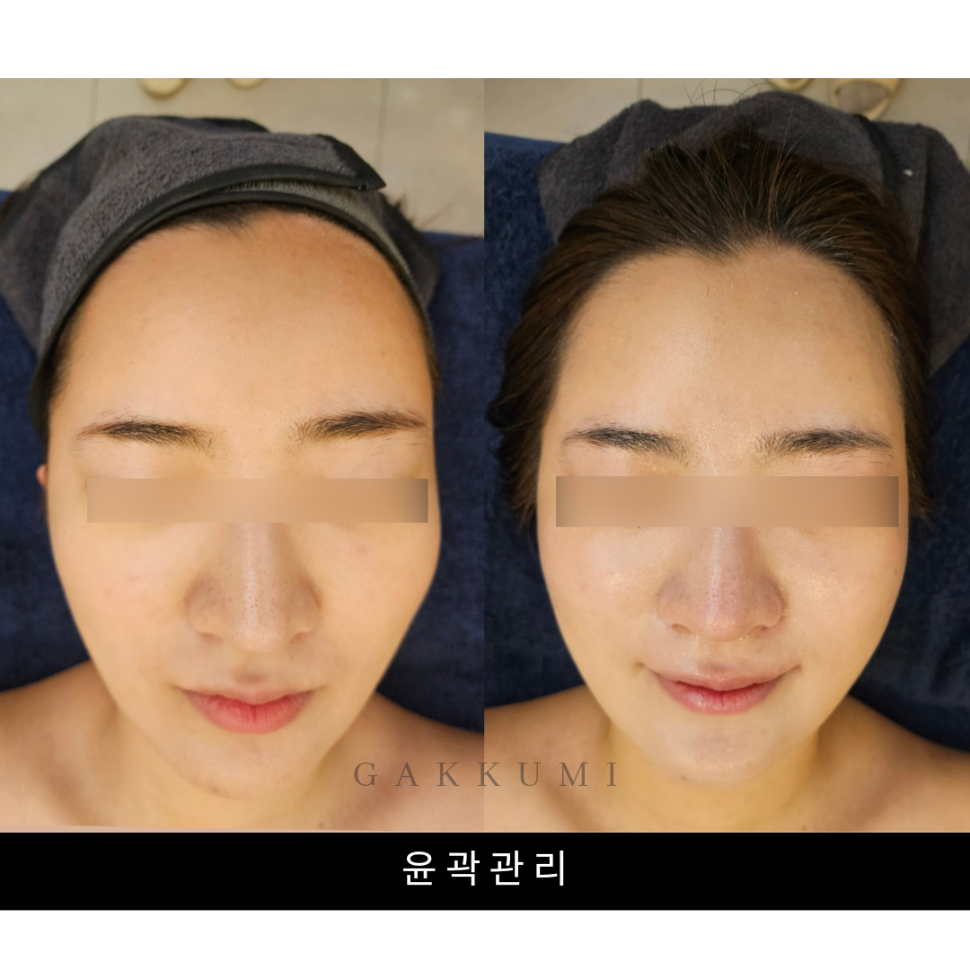 가꾸미 스킨앤바디