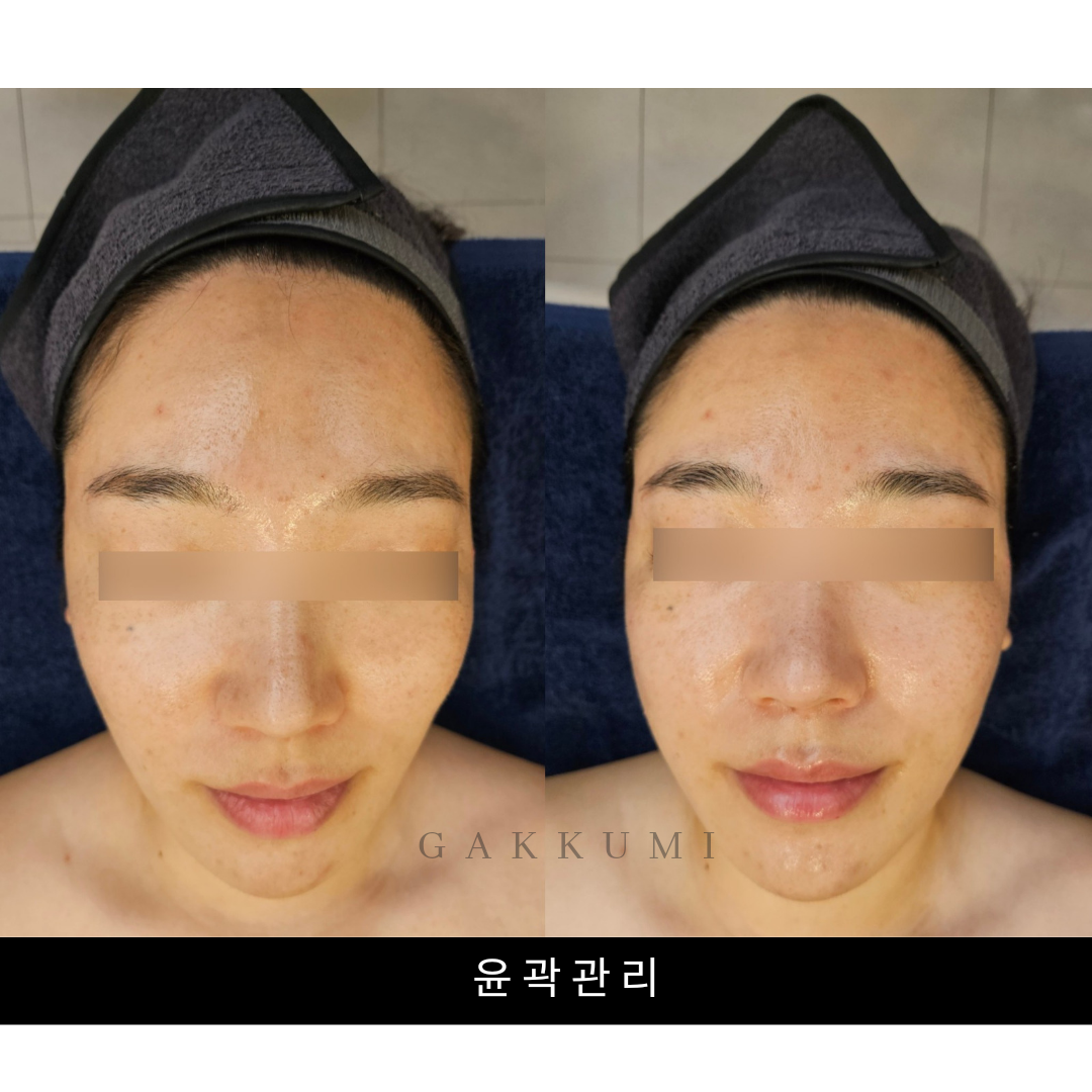 가꾸미 스킨앤바디