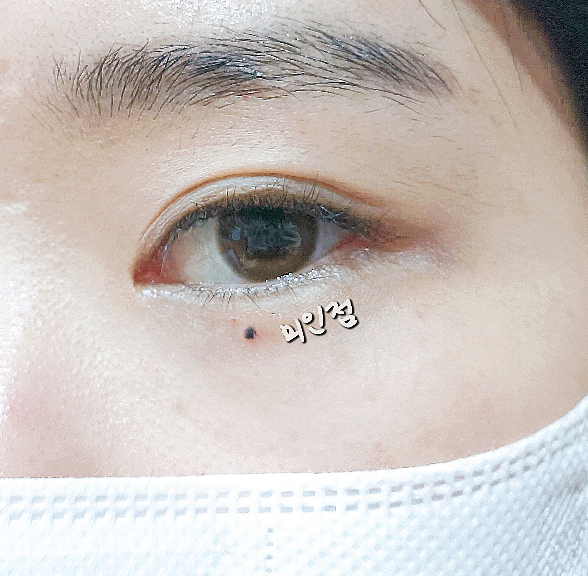 안나래쉬 대표 이미지