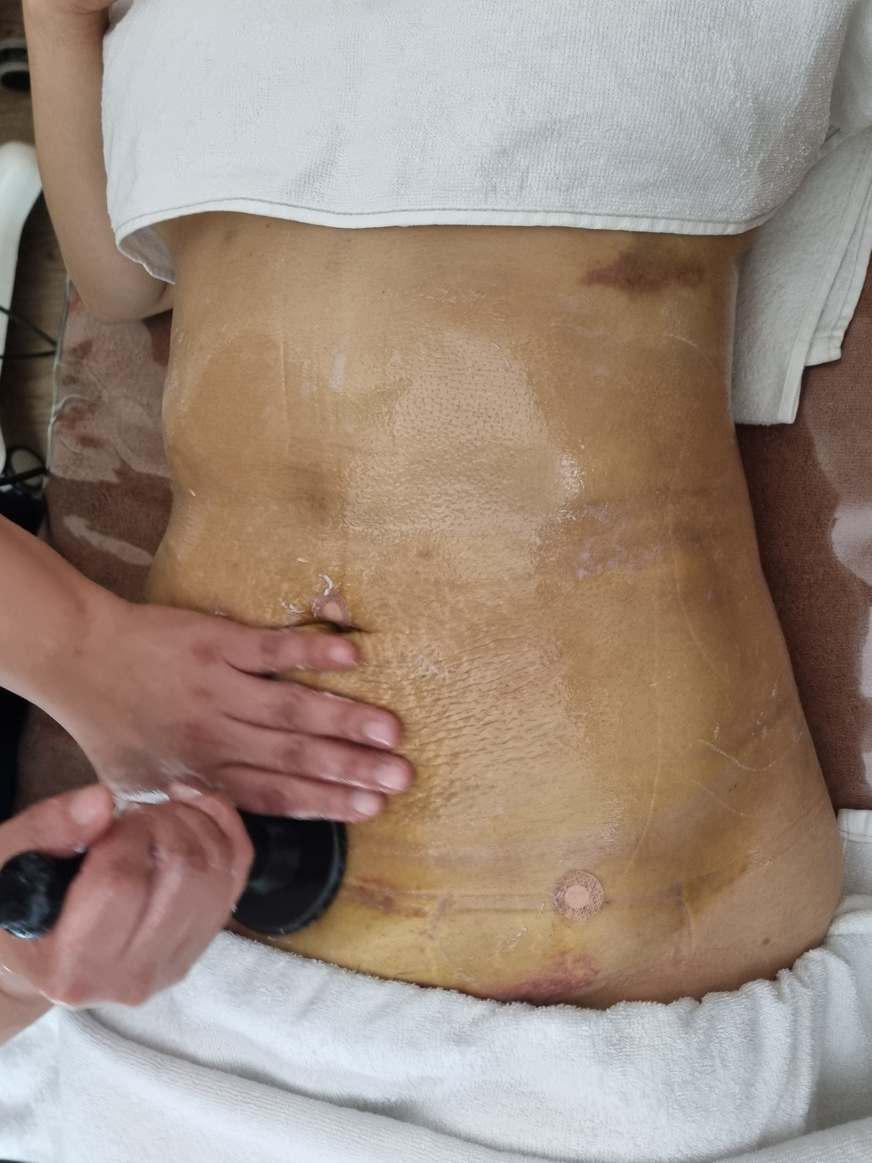 스킨포유 대표 이미지