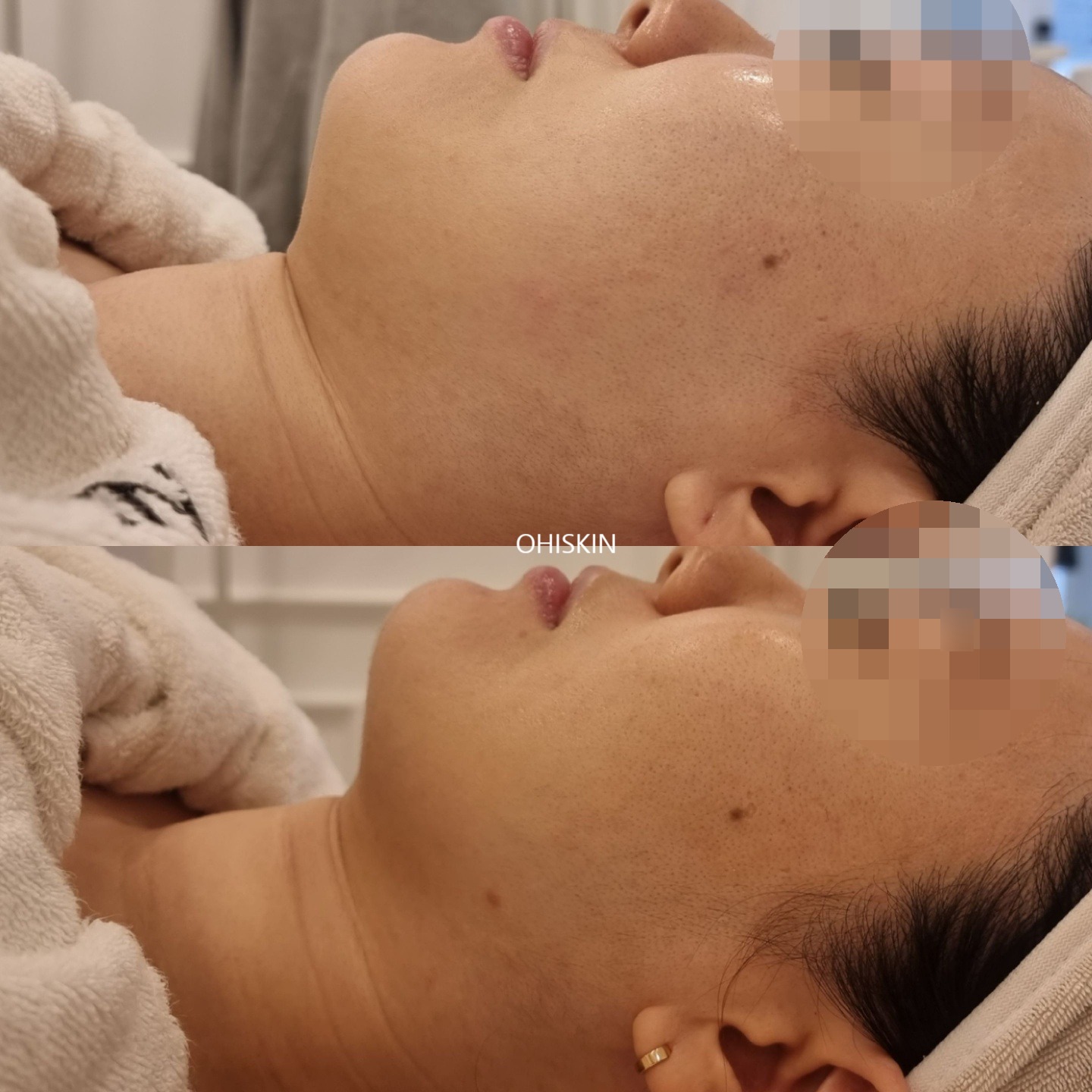 오하이스킨 대표 이미지