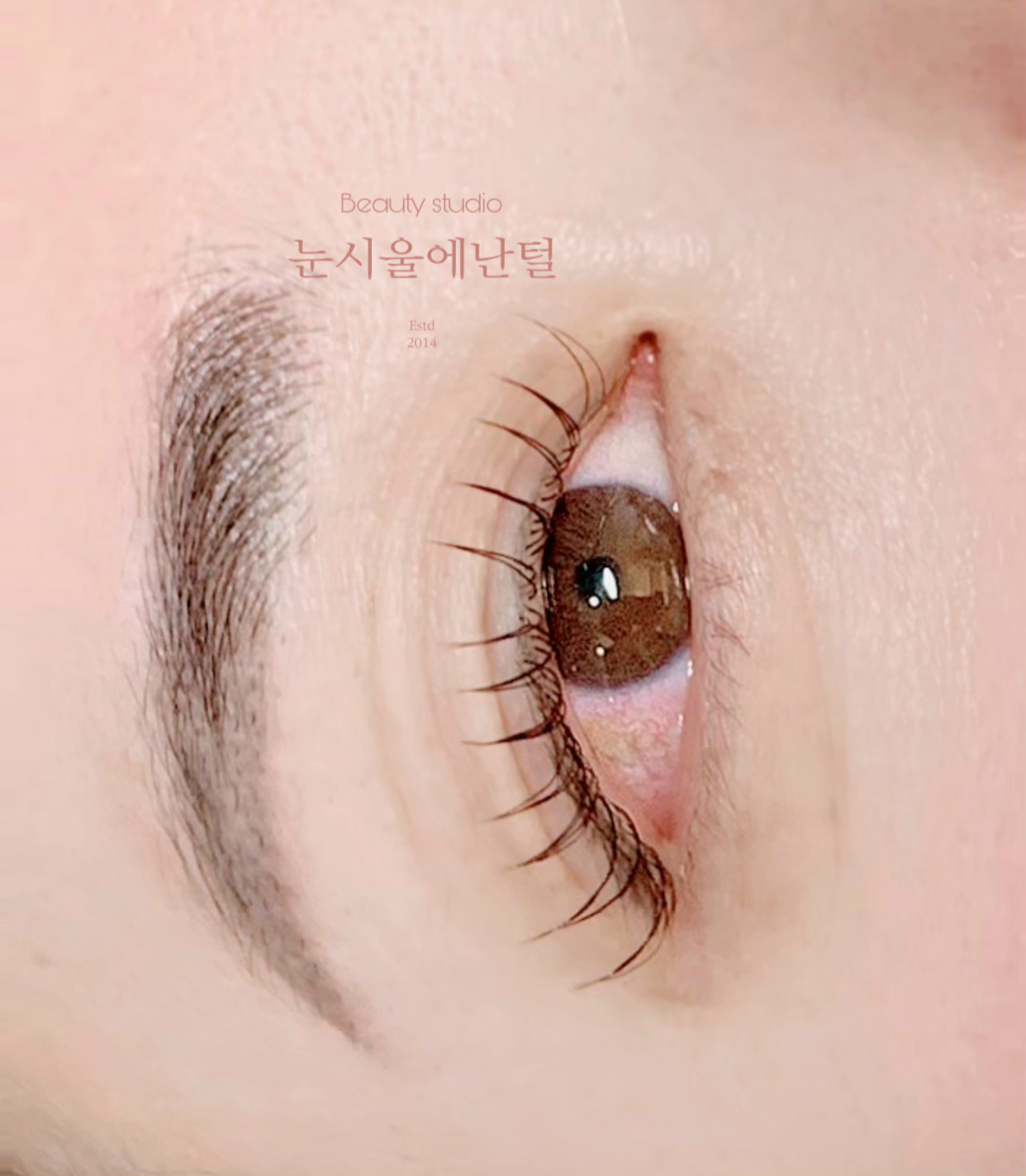 눈시울에난털
