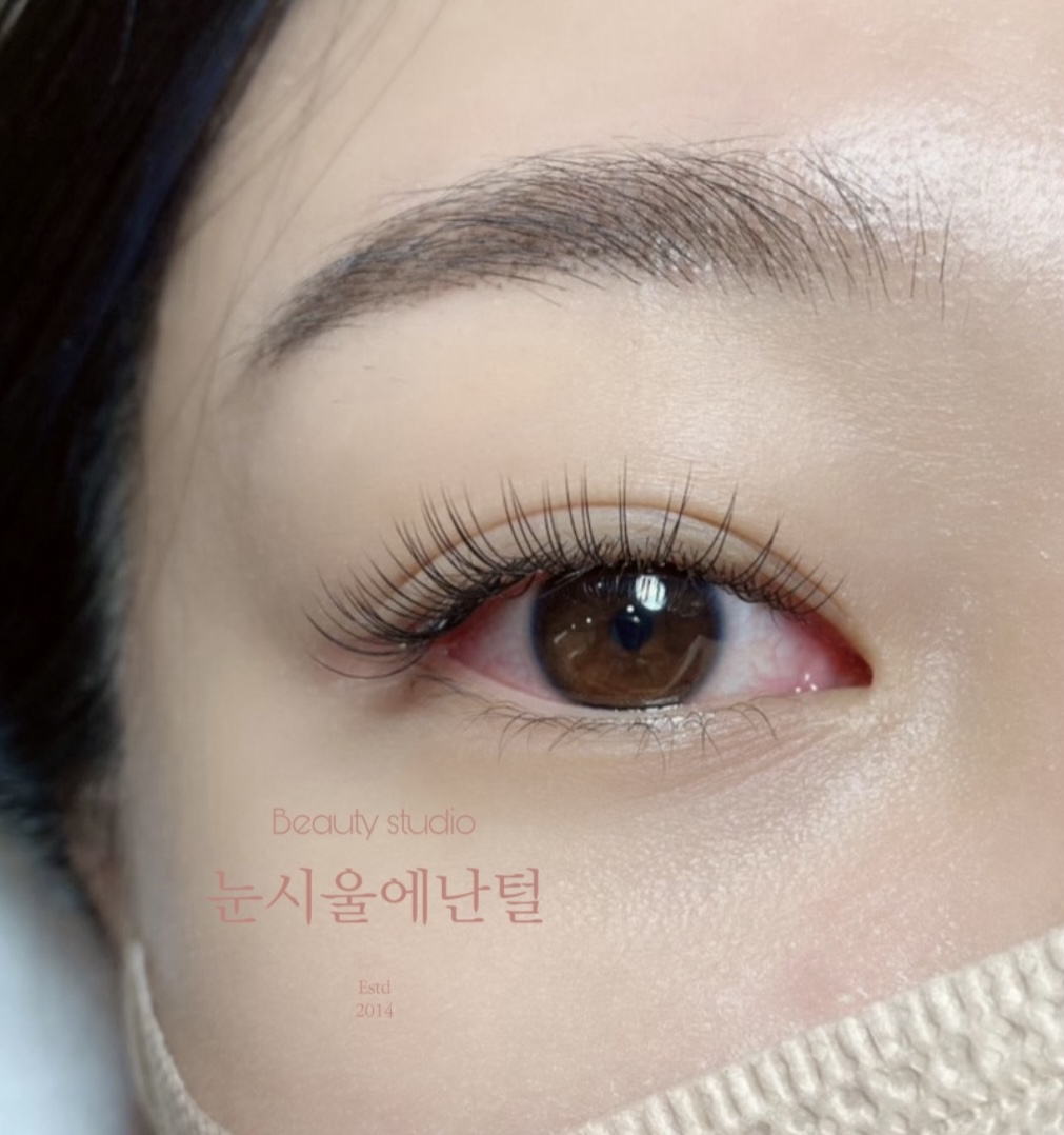 눈시울에난털
