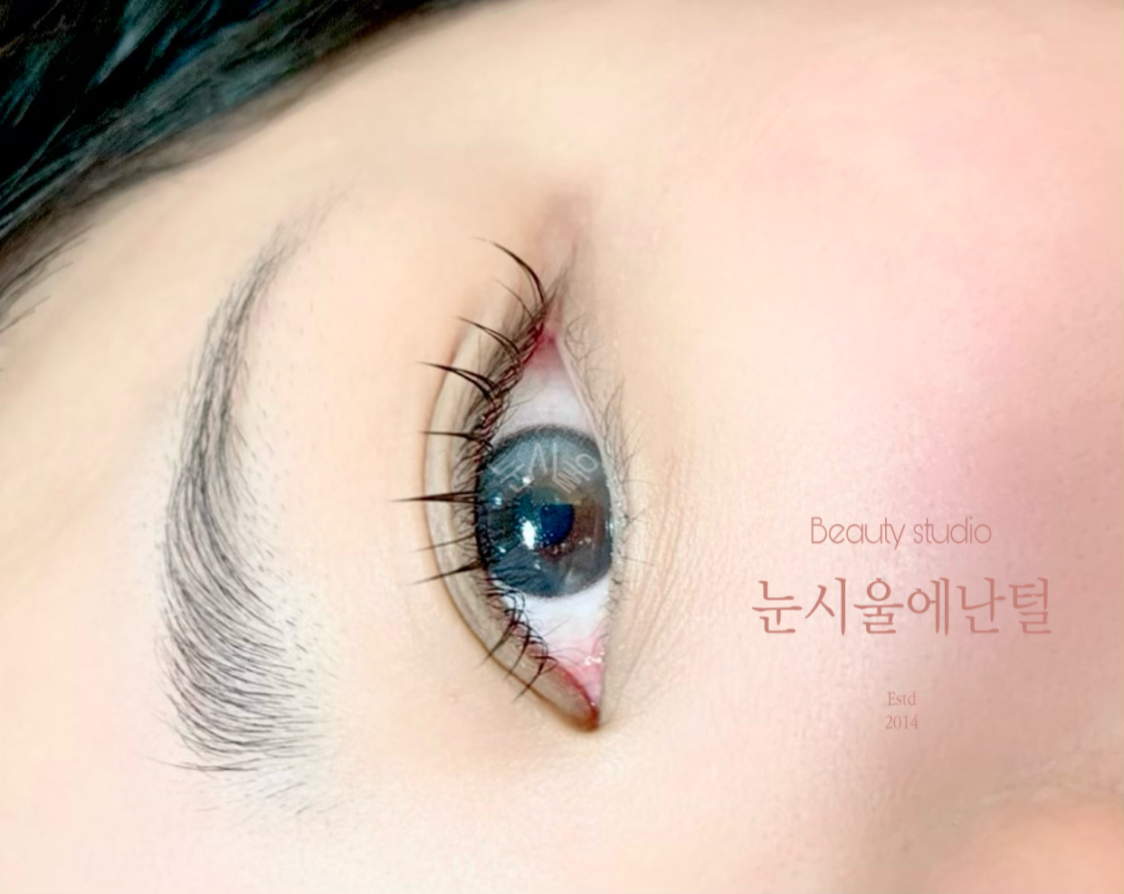눈시울에난털