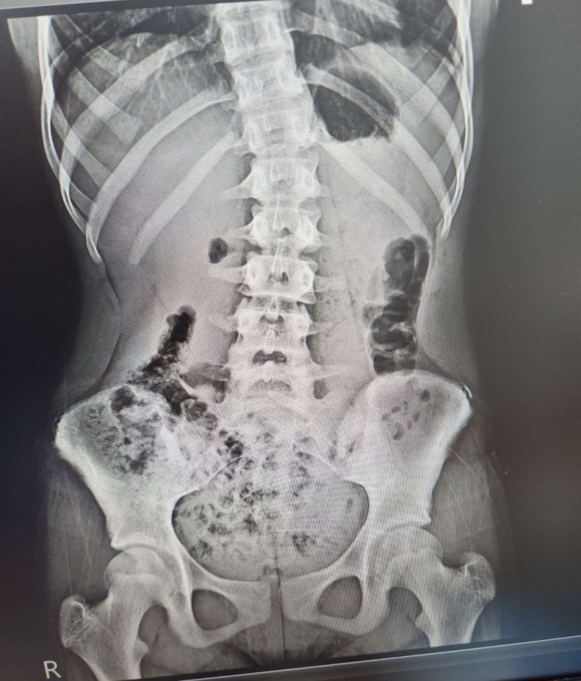 트라이필라테스 평창동점 대표 이미지