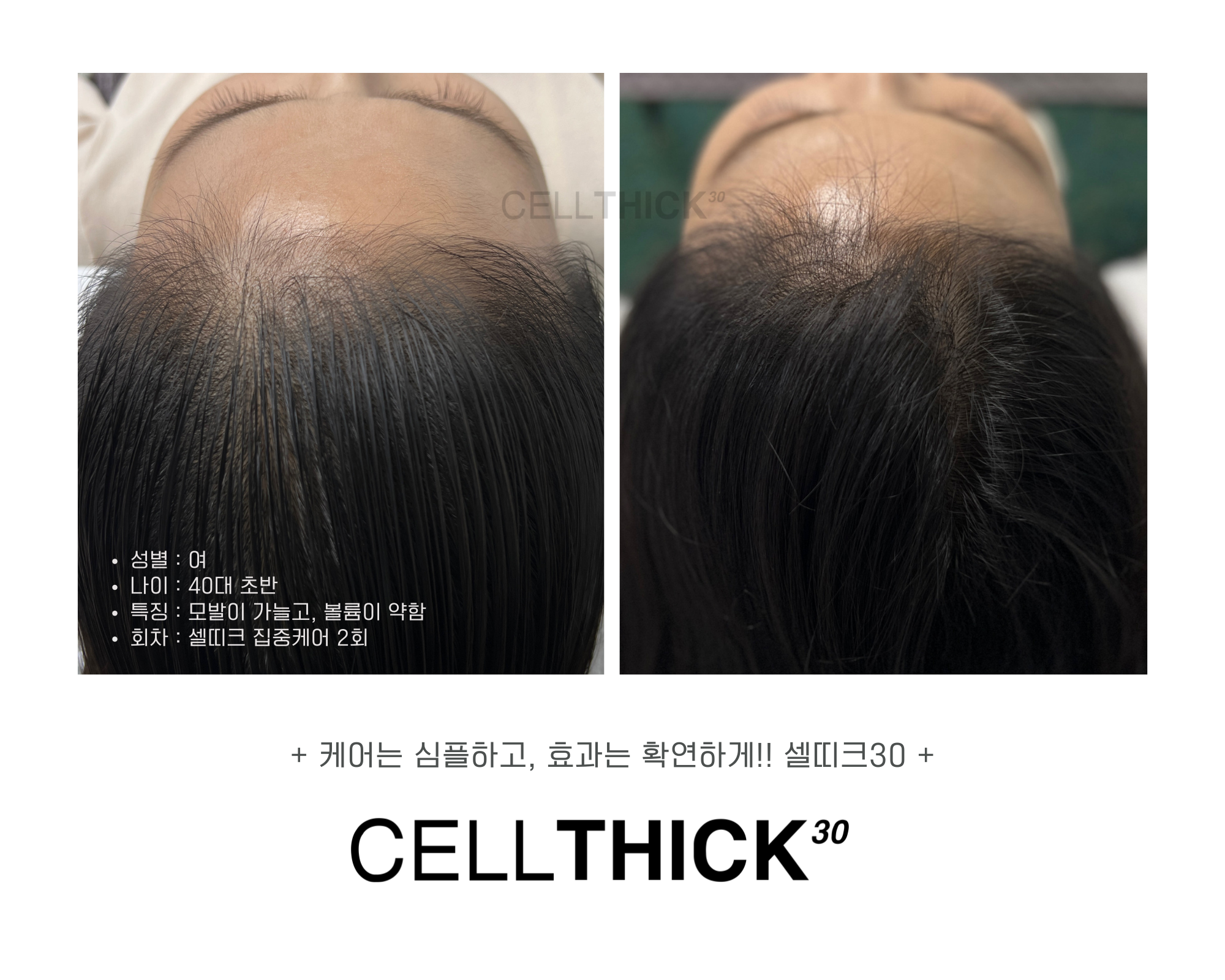 셀띠크30&반야로운 대표 이미지