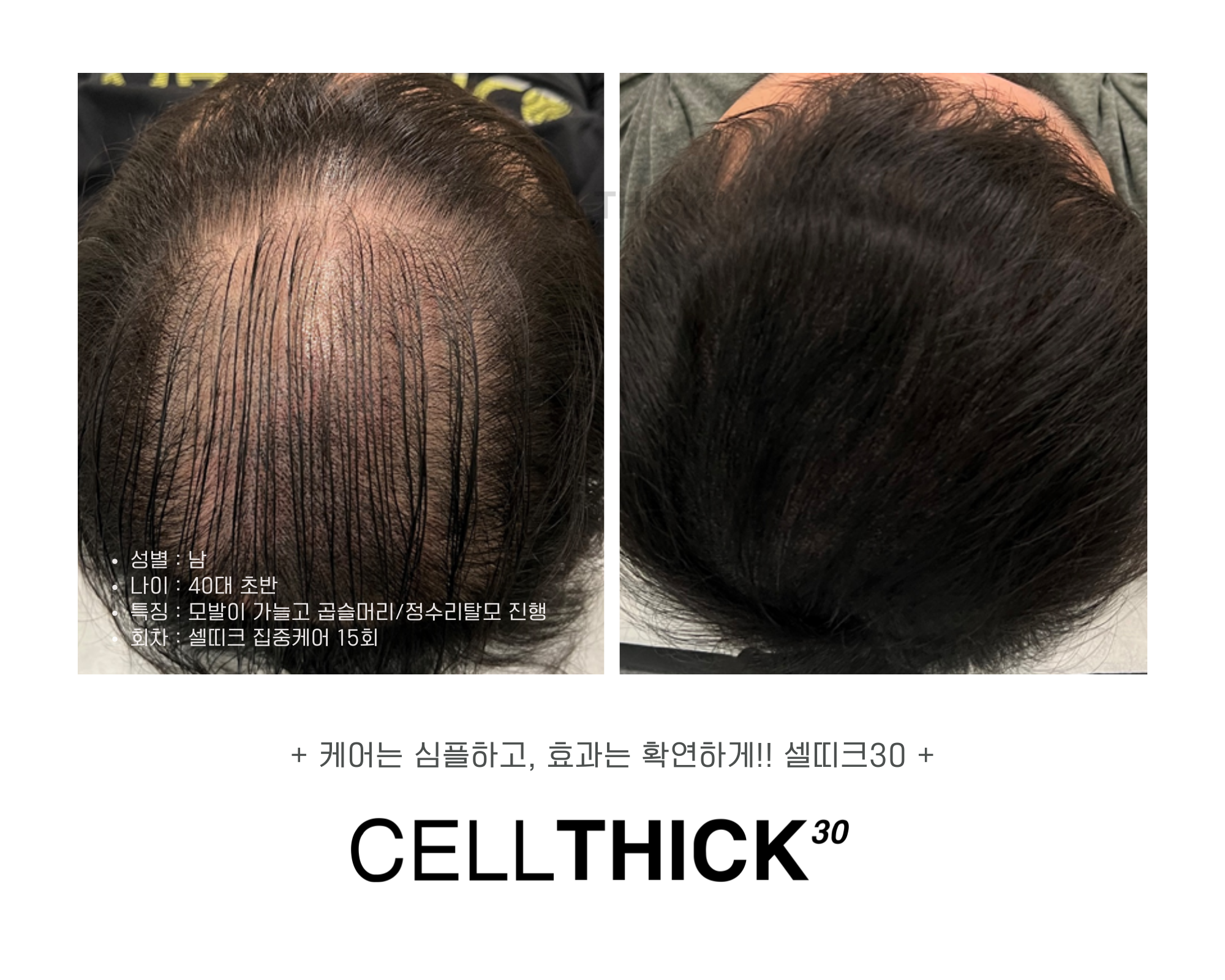 셀띠크30&반야로운