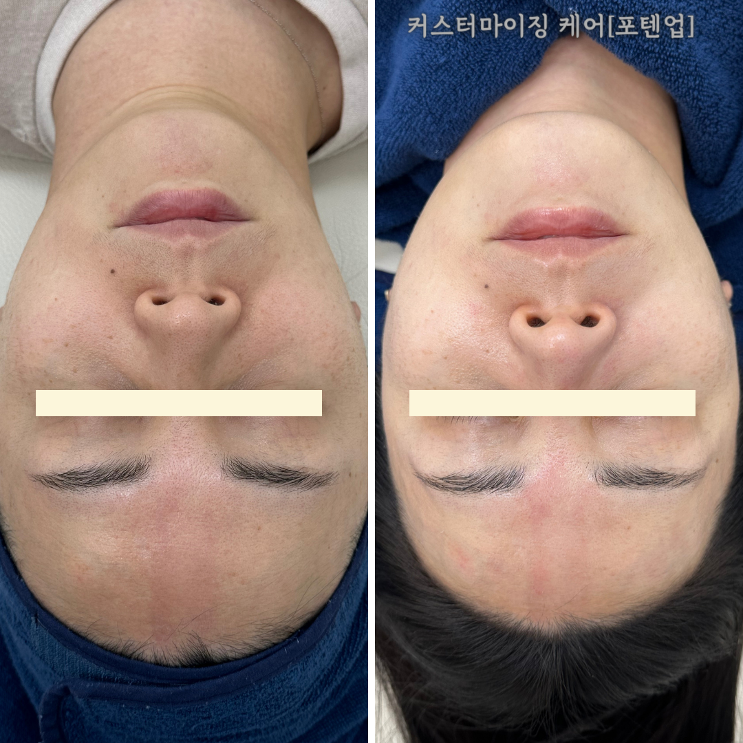 프리시엘 스킨 대전본점