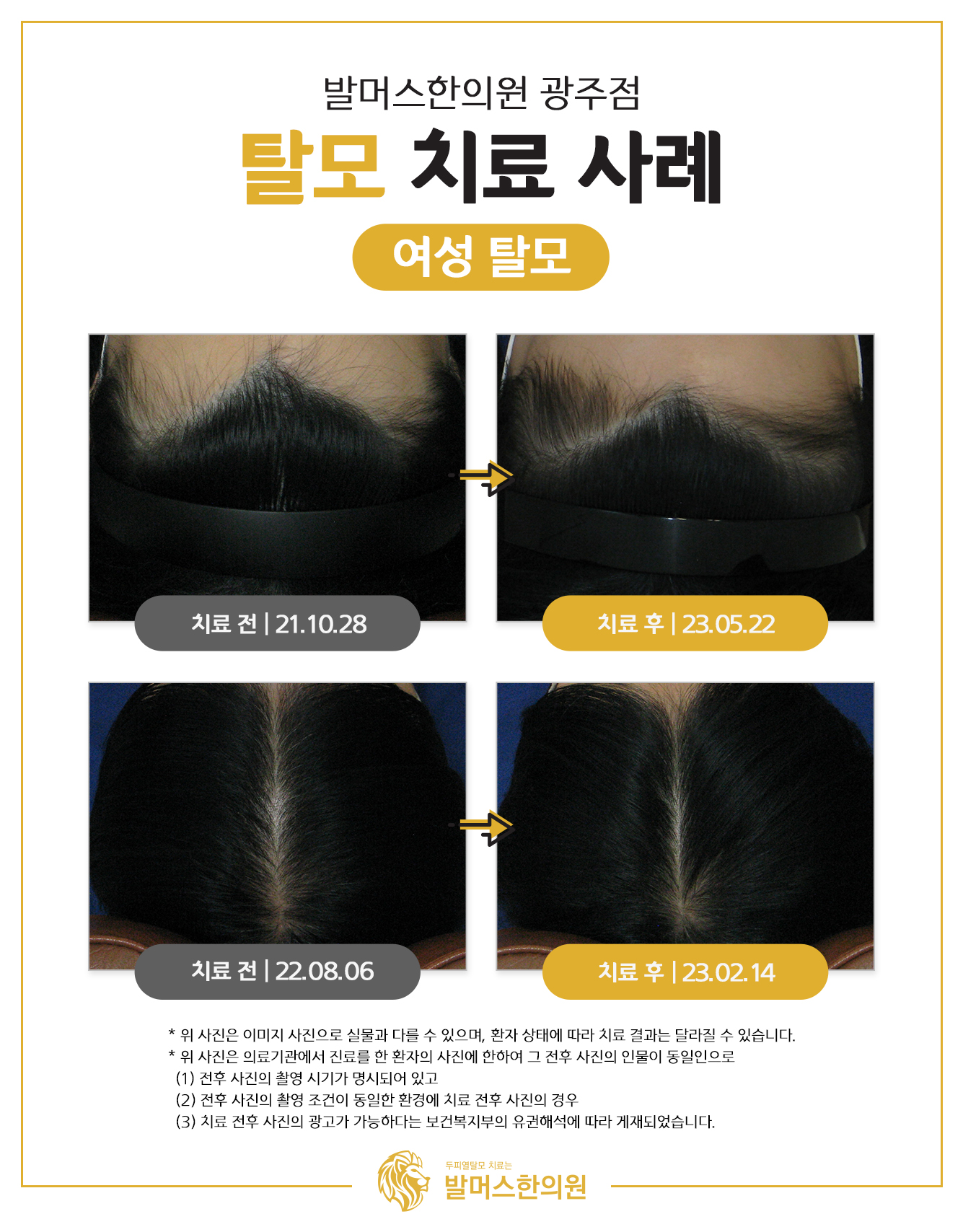 발머스한의원 대표 이미지