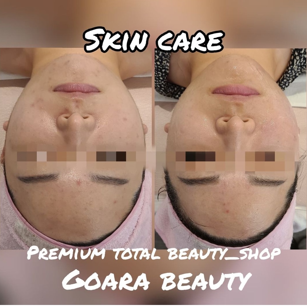 고아라뷰티 대표 이미지