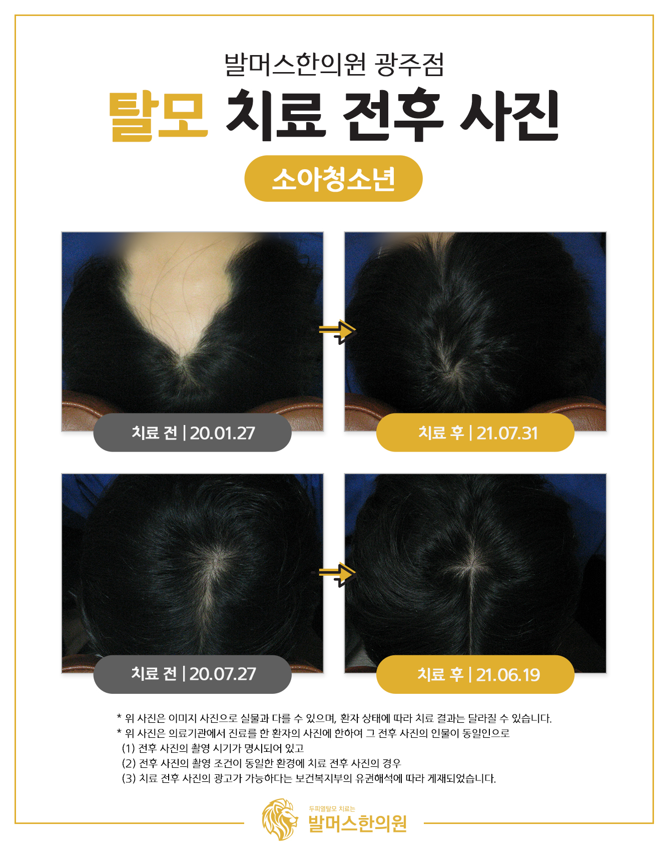 발머스한의원 광주