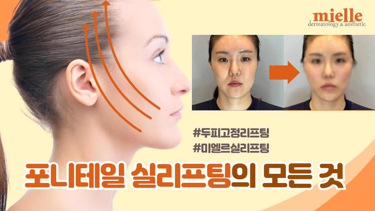미엘르의원 부산서면