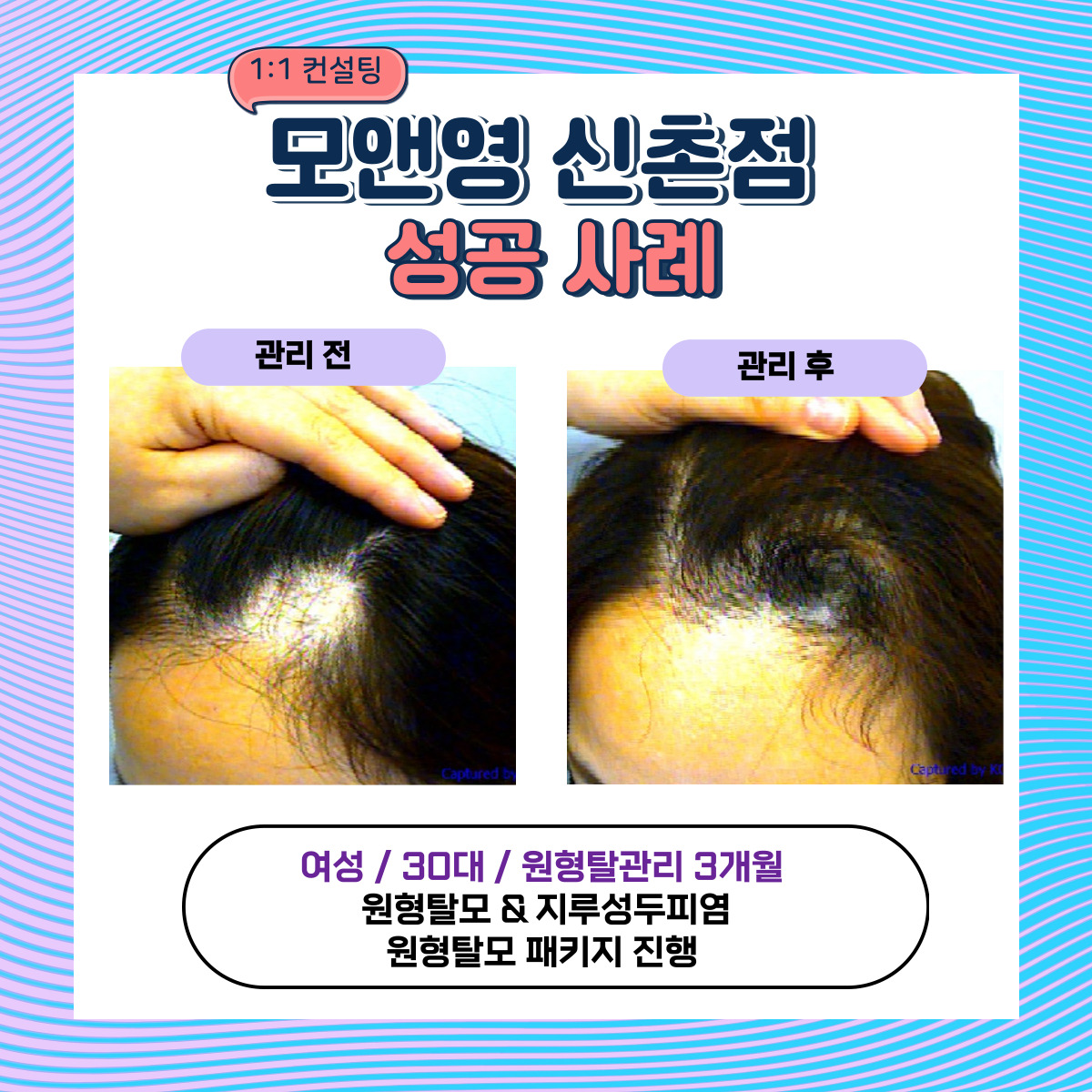 모앤영 신촌점 대표 이미지