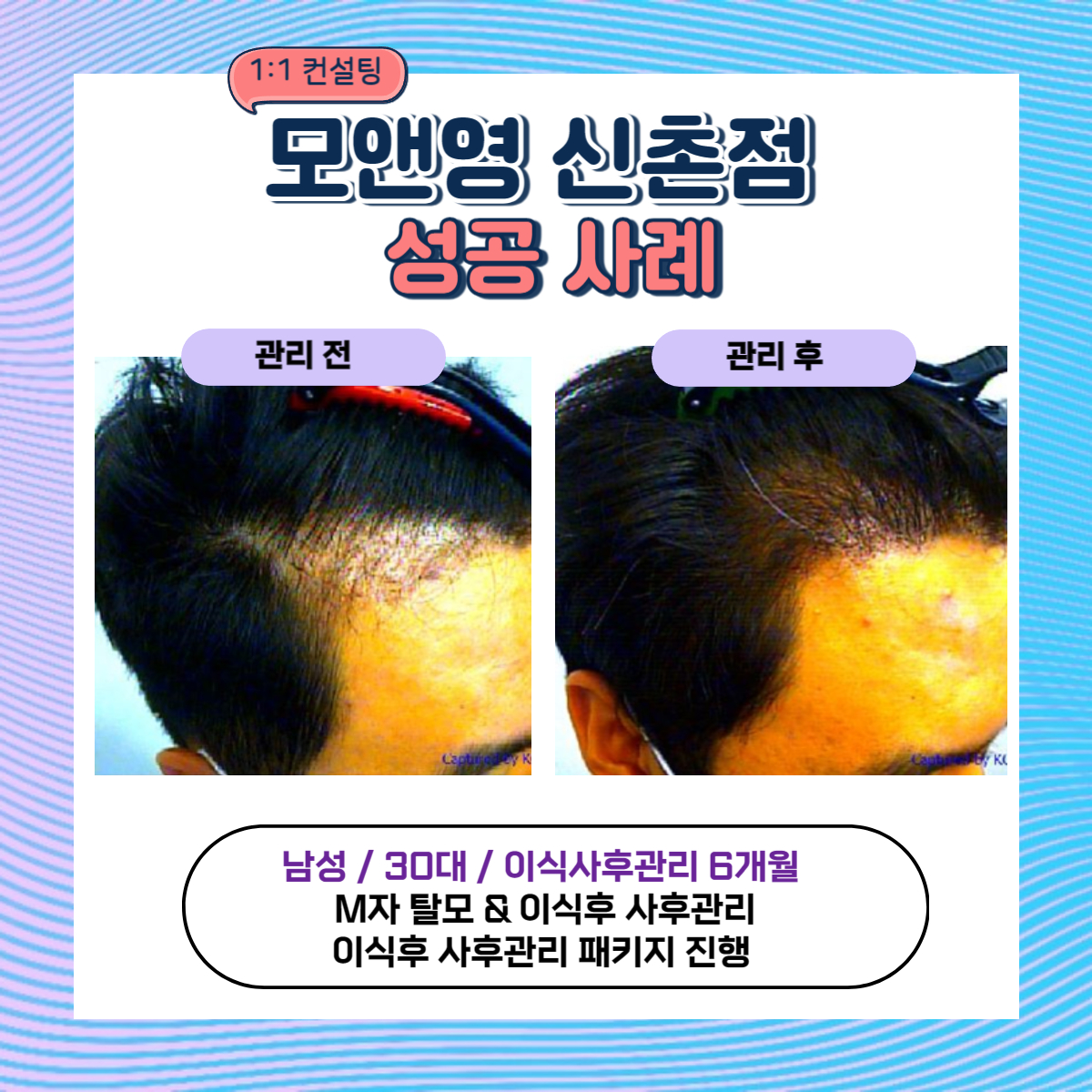 모앤영 신촌점 대표 이미지