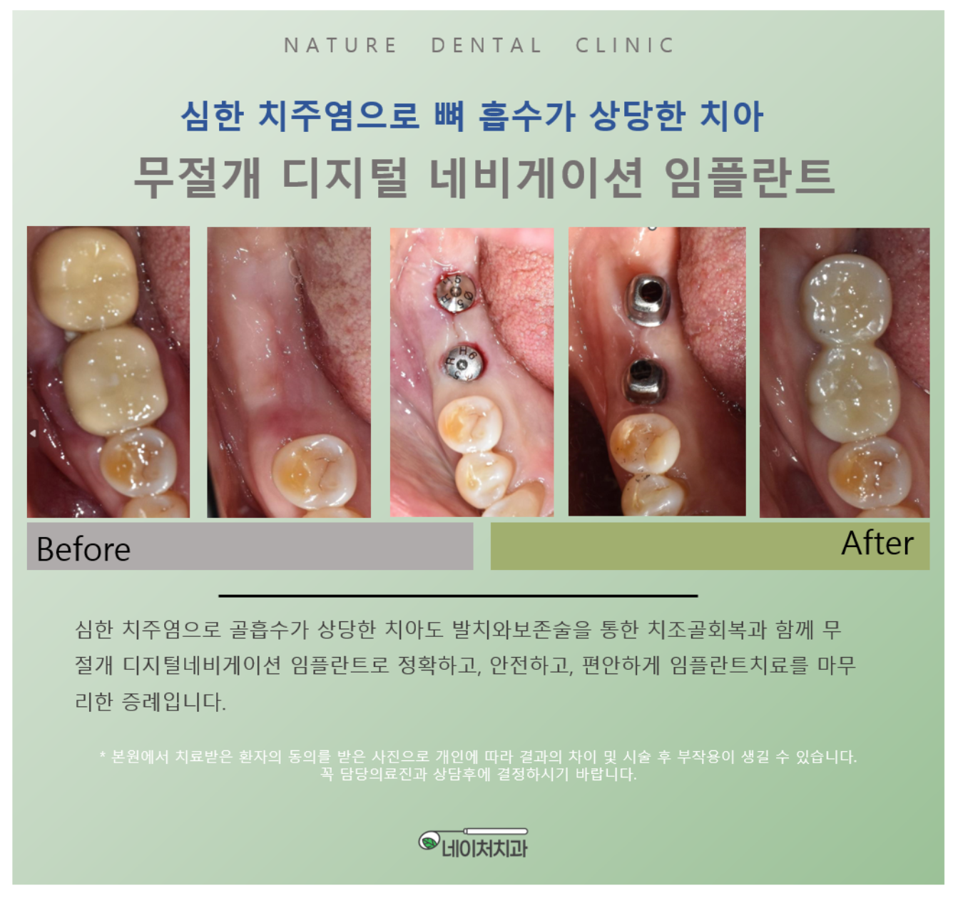 네이처치과의원 대표 이미지