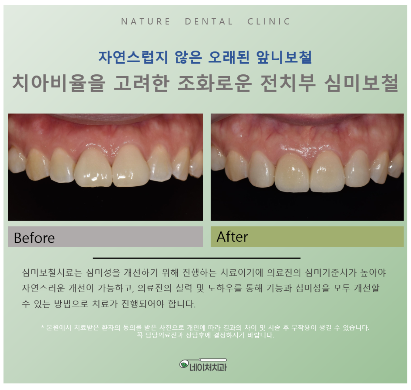 네이처치과의원 대표 이미지