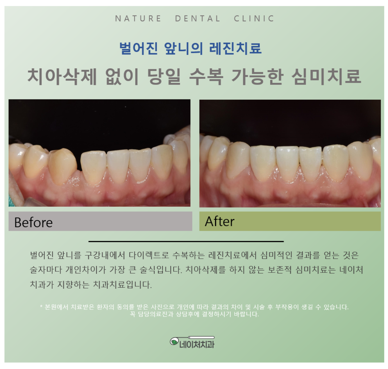 네이처치과의원 대표 이미지