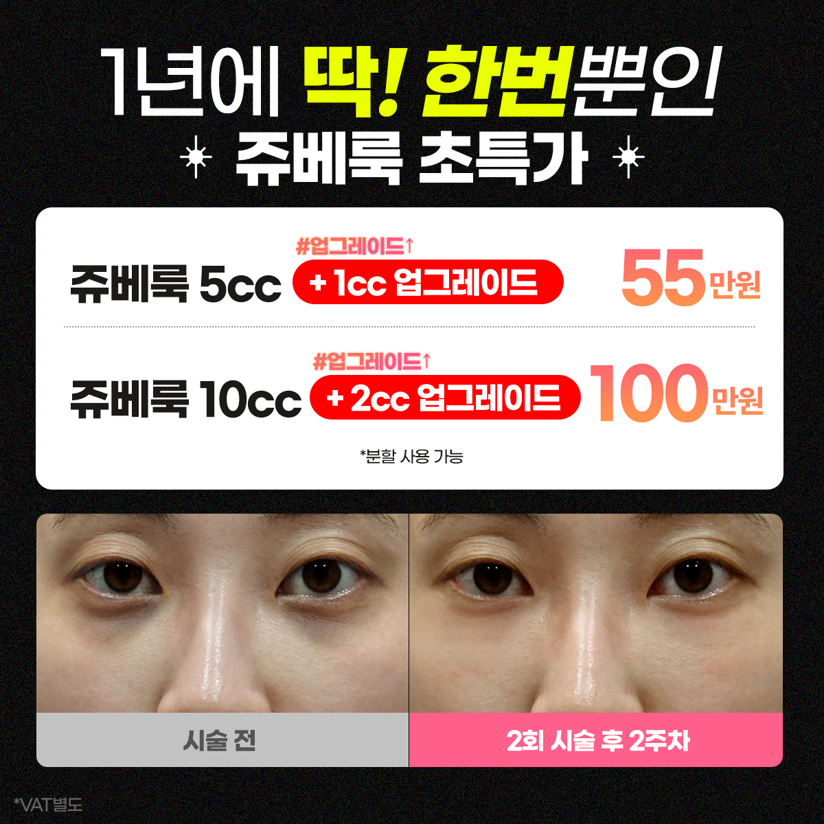 VS라인의원 압구정점