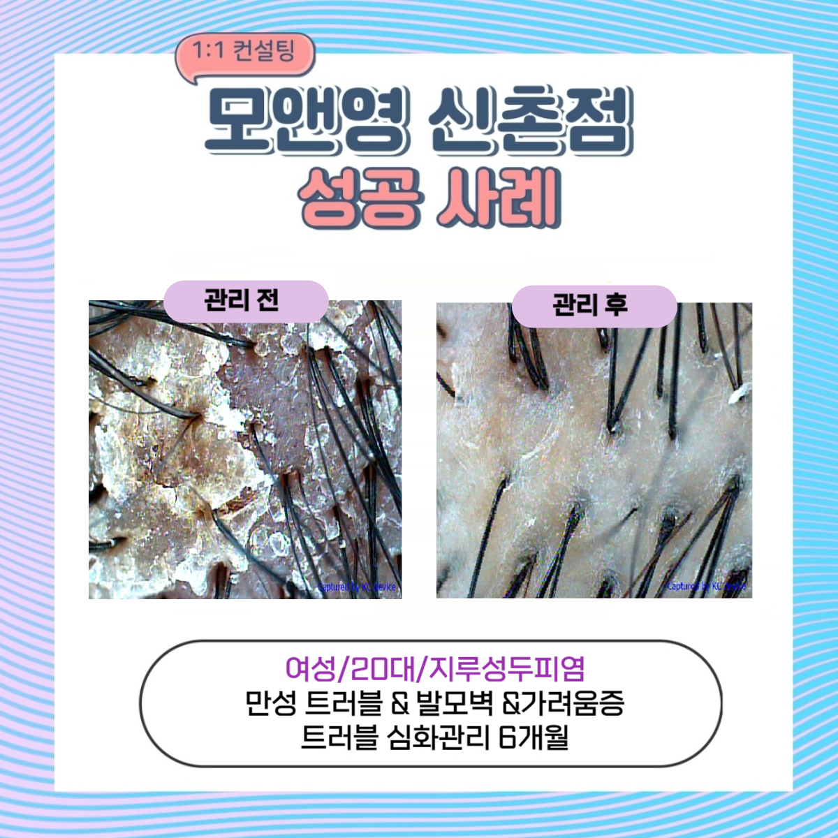 모앤영 신촌점 대표 이미지