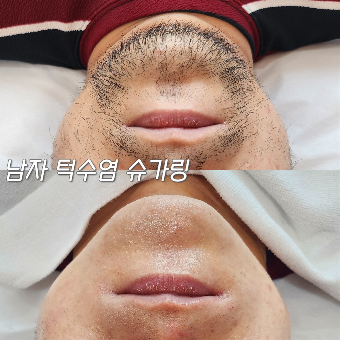 매료한 슈가링왁싱&스킨 명지점